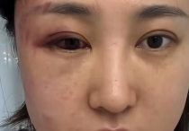 34岁女星徐大宝遭家暴后  还是给她造成不可磨灭心理阴影