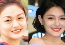 王菲柳岩大S等女星都曾坦言打过瘦脸针（如今备受欢迎的莫过于打瘦脸针了）
