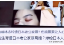 林志玲与哪些女明星不合  有网友曝出林志玲遭到家暴假体被打出