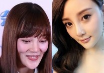 王贝因整容去世（整容的风险是很高年仅24岁的她看完后作何感想）