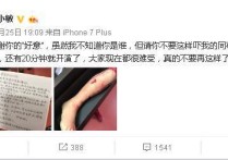 汪小敏整容前后照（曾被粉丝送假肢恐吓出道11年被指没特点汪小敏是该找到出路了）