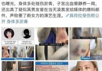 具荷拉事件是什么详细始末曝光（一起来看看具荷拉事件全过程吧）