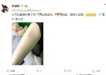 美女主播张琪格户外变形记挑大粪     七哥全程素颜运动装出境