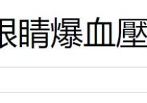 59岁辛晓琪疑身体出状况（眼白变红几乎全都爆血管了十分恐怖）